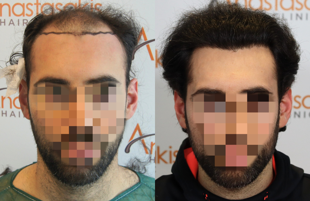 ΑΓΓΕΛΟΥ (2).png