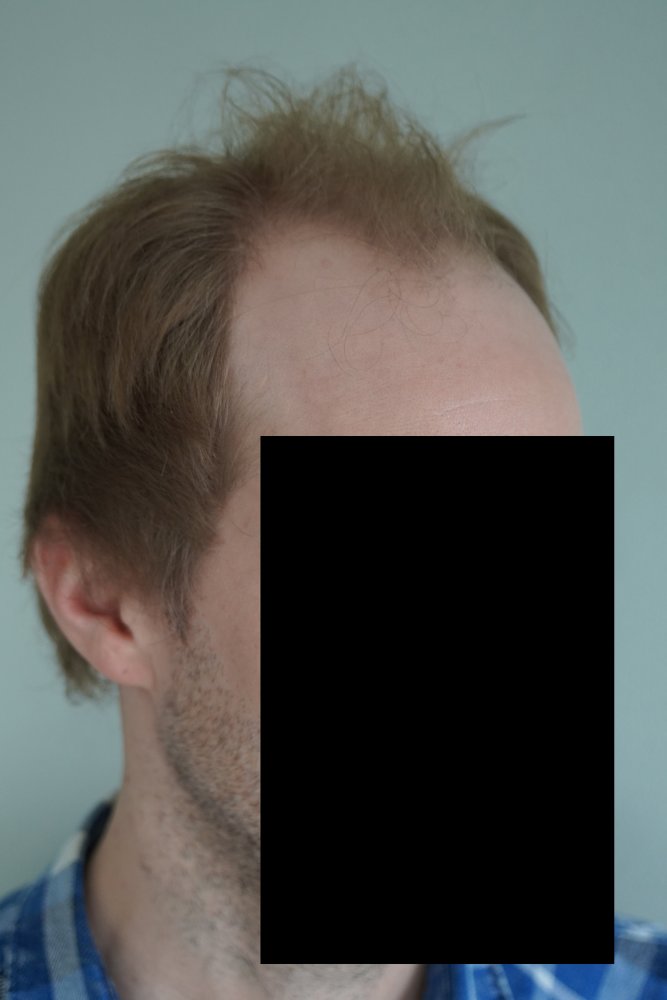 02 seitlich.jpg