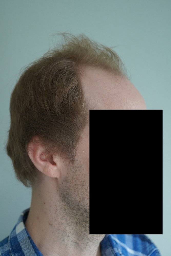 03 seitlich.jpg