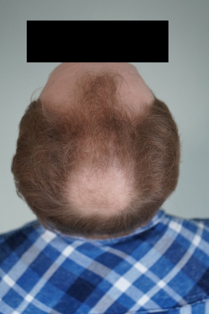 05 oben.jpg