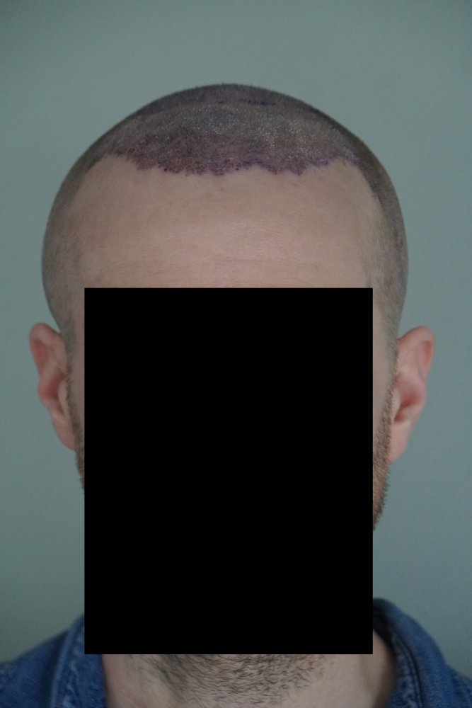 06 Op vorne.jpg