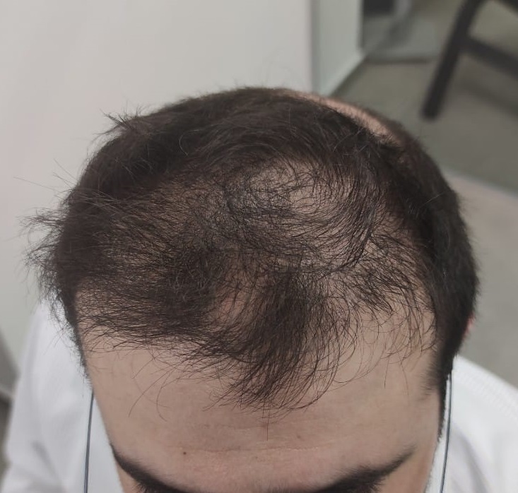 1. Before Front.jpg