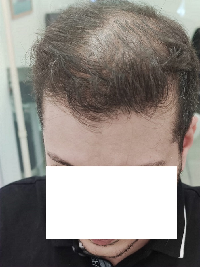 1. Before Front.jpg