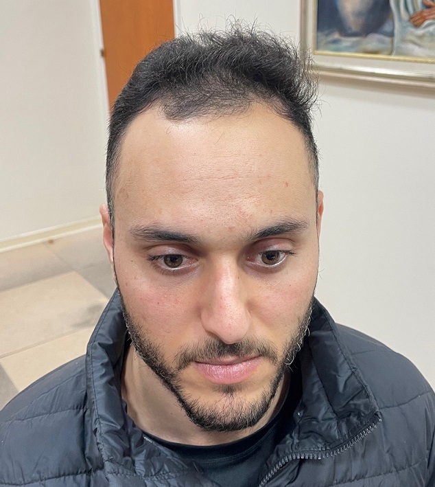 1. Before full face.jpg