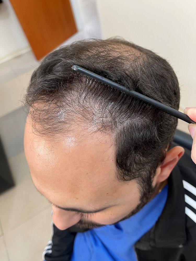 1. Before.jpg