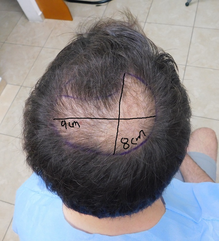 1. Before.JPG