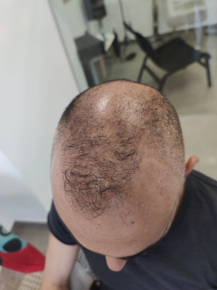 1 before.jpg