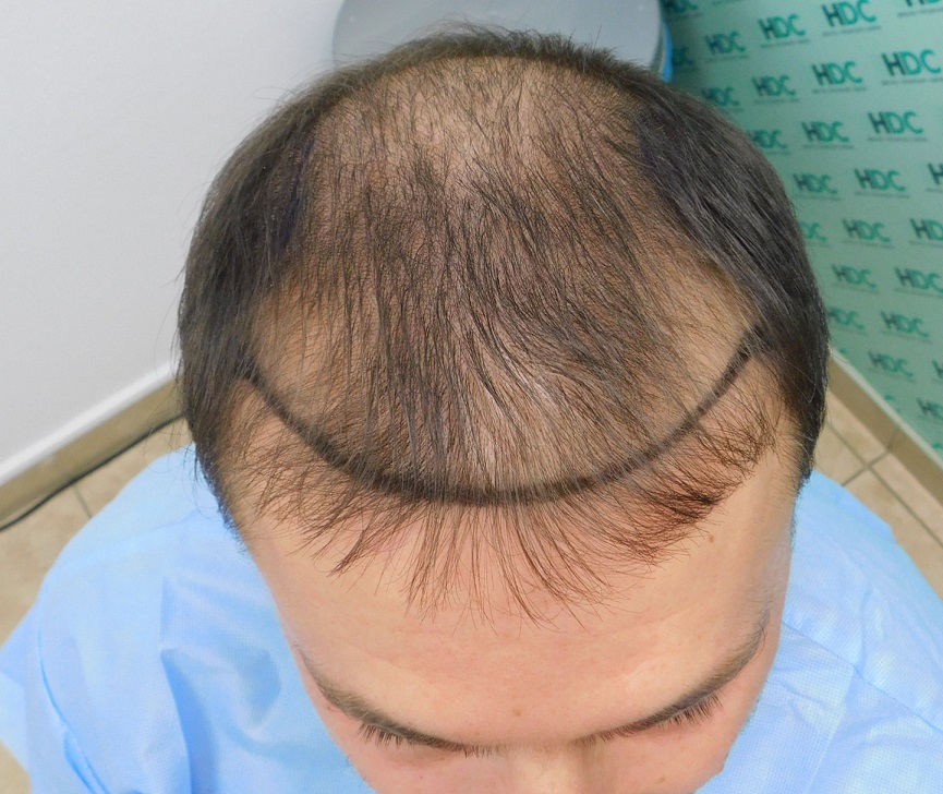 1. Before.JPG