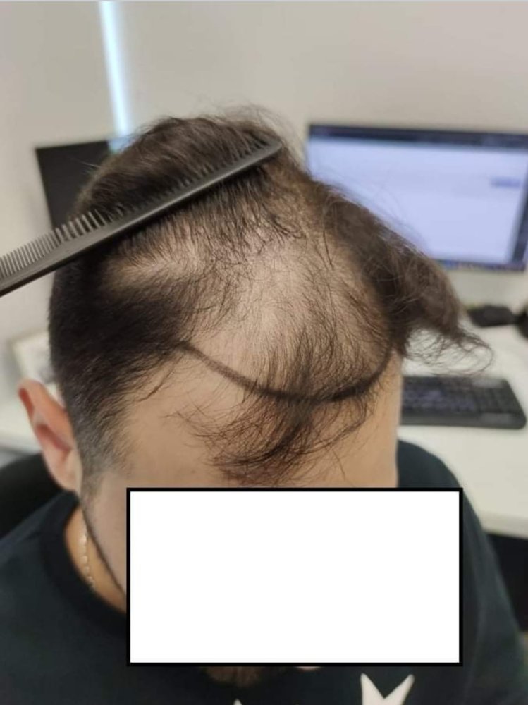 1. Before - Right.jpg