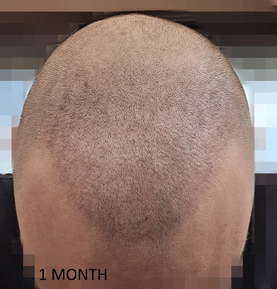 1 MONTH.jpeg