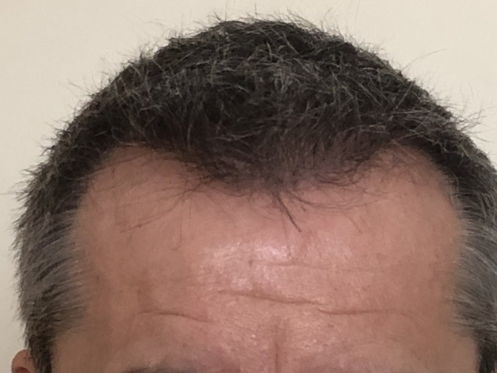 10.5 months after haircut 4165.JPG