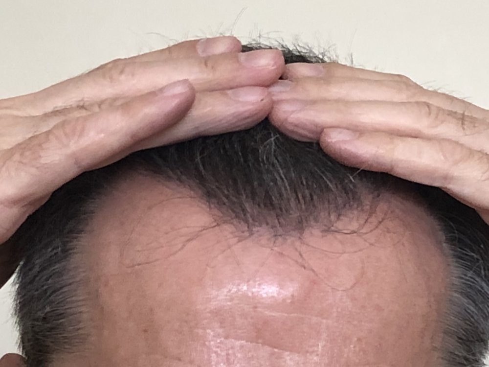 10.5 months after haircut 4167.JPG
