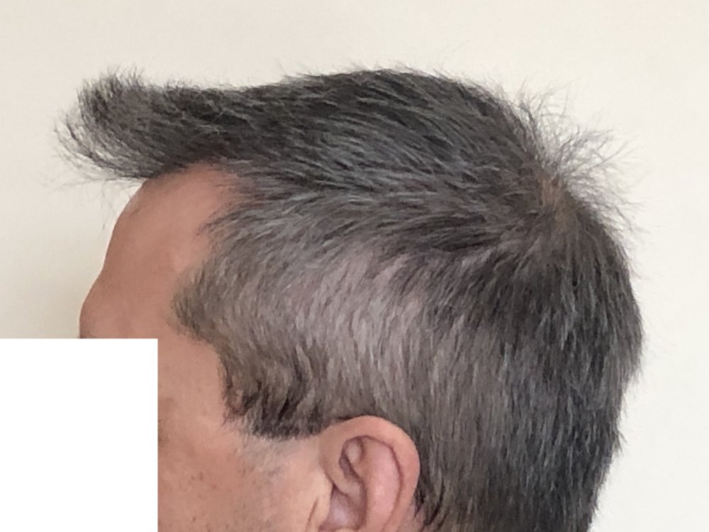 10.5 months after haircut 4170.JPG