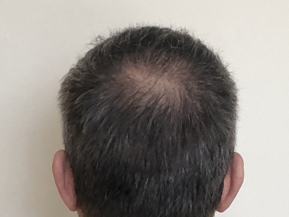 10.5 months after haircut 4171.JPG