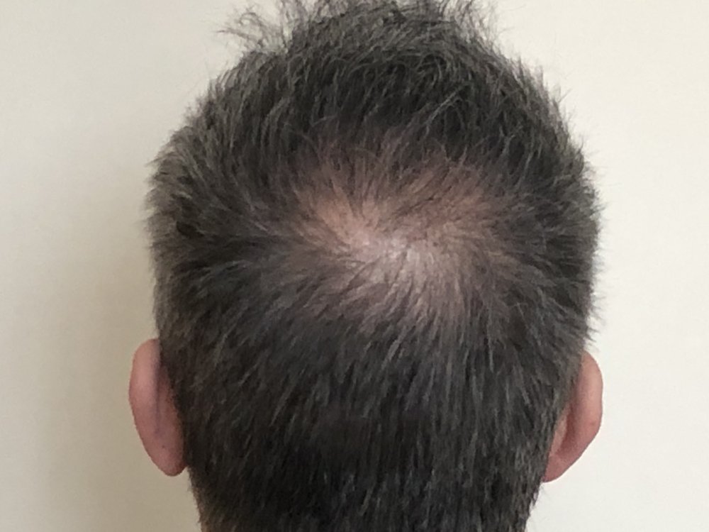 10.5 months after haircut 4173.JPG