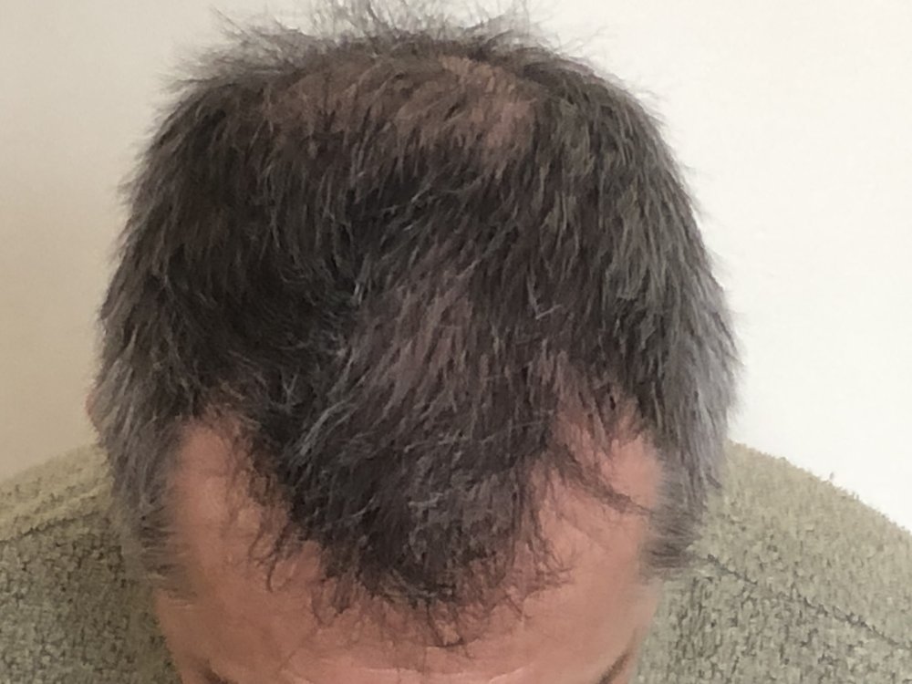 10.5 months after haircut 4174.JPG