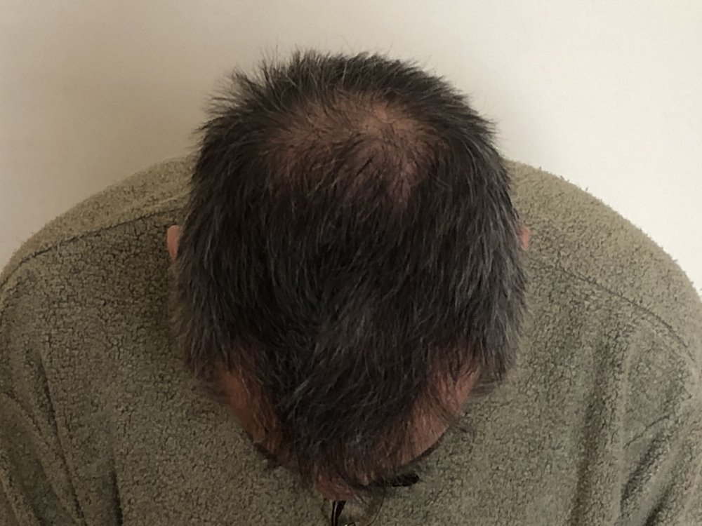 10.5 months after haircut 4175.JPG