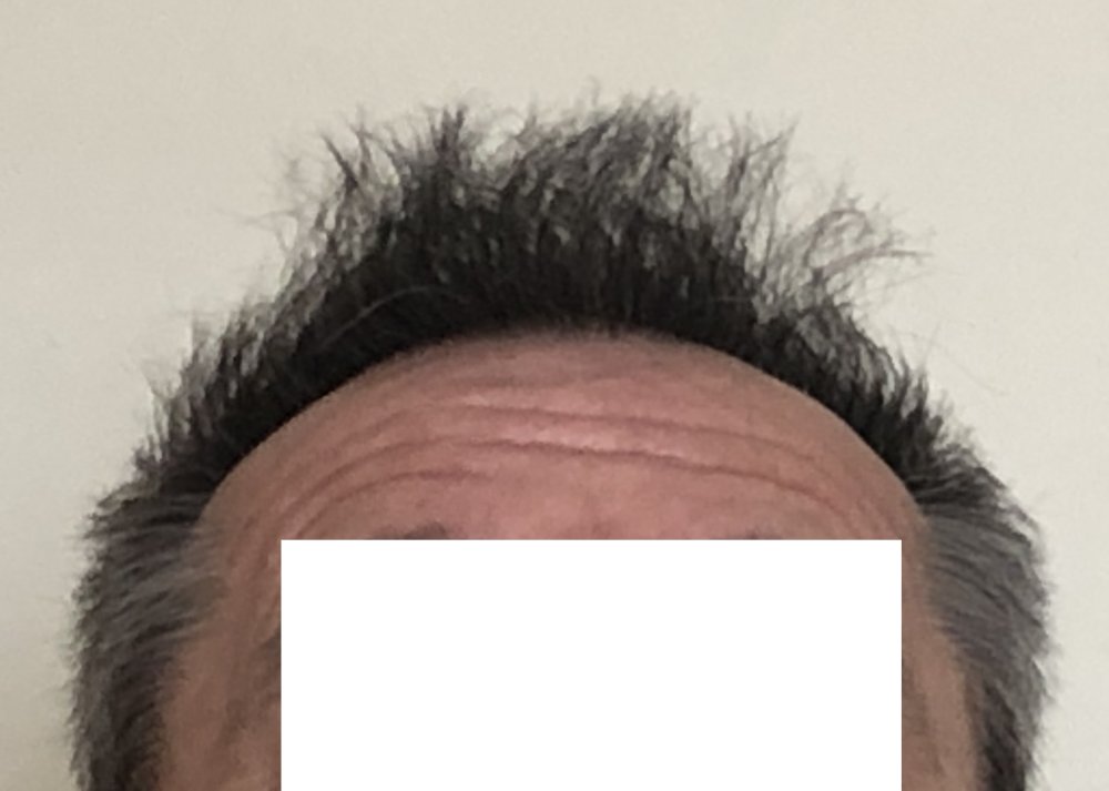 10.5 months after haircut 4177.JPG