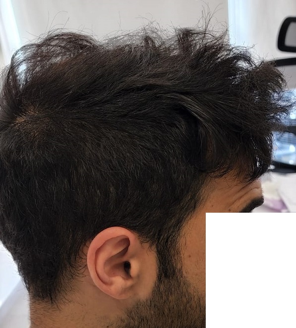 10. After right side view.jpg