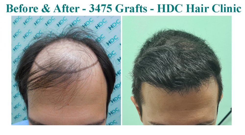 10. Comparison 1.jpg