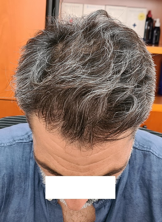 10. Result top view.jpg