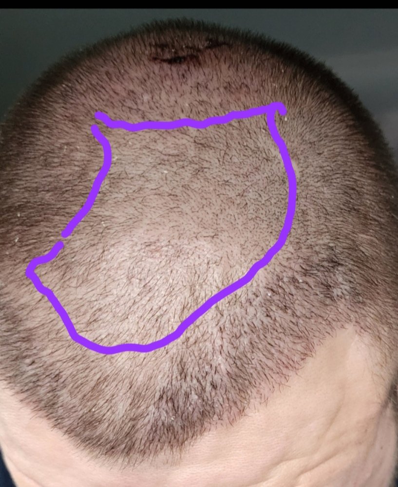 1000034584.jpg