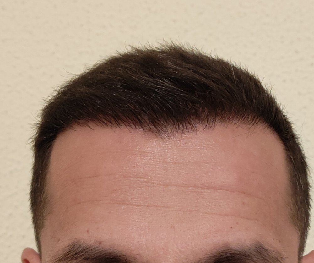 1000184619.jpg