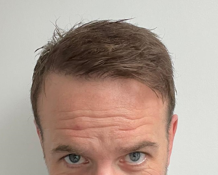 11. After Front.jpg