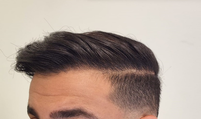 11. After - Left side.jpg