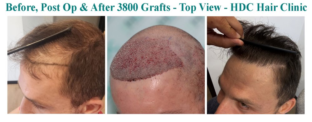 11. Comparison -  Before post op and after.jpg