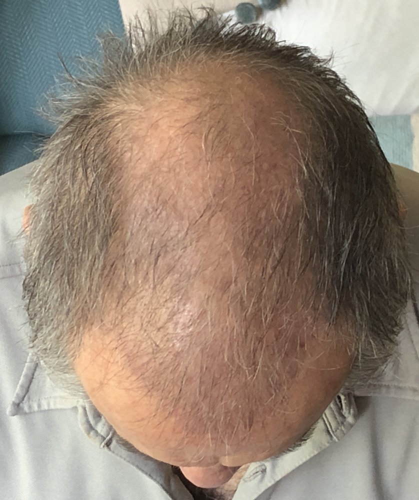 11 weeks Above 2927.JPG