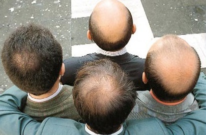1183_baldnesscrop.jpg