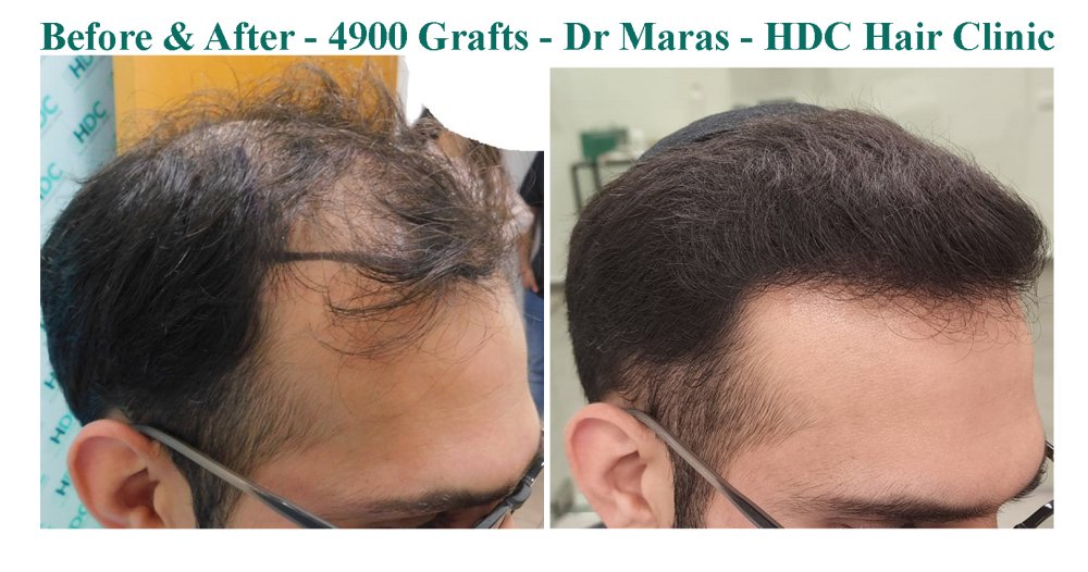 12. Comparison right side.jpg