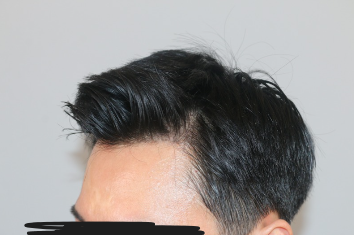 12.png