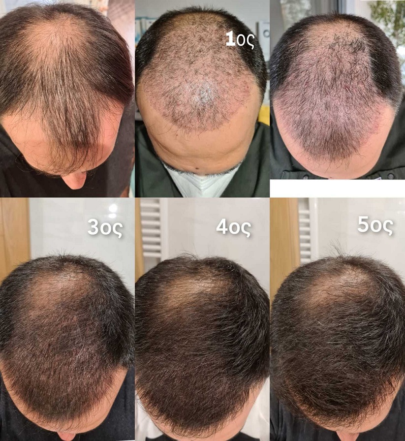 13. 0 to 5 months Development.jpg