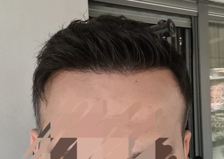 14. 7 months front 2.jpg