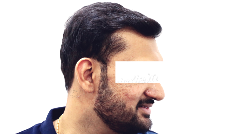 14.png