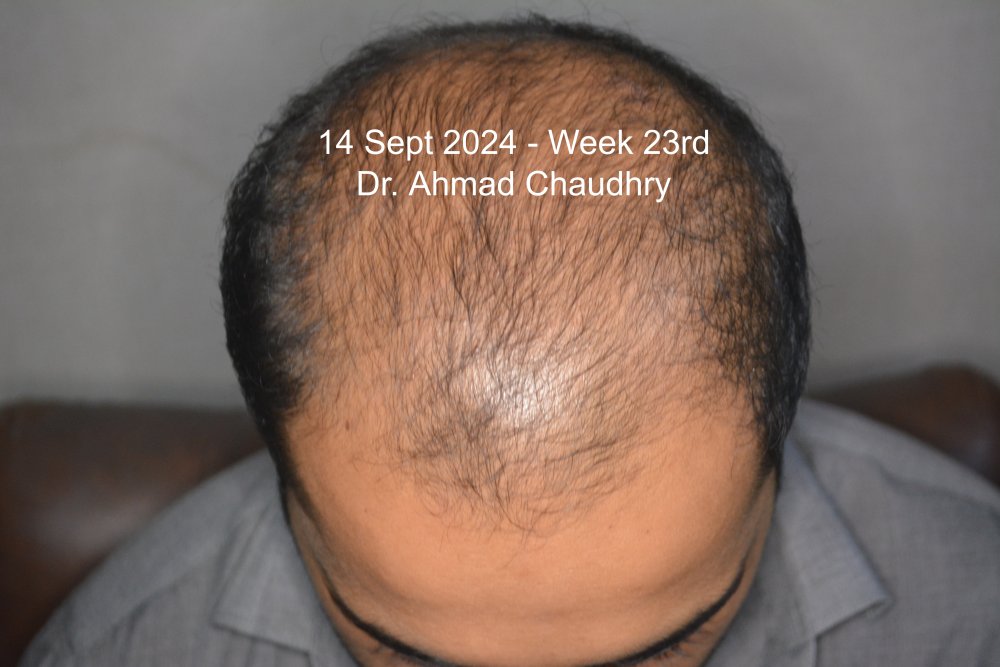 14 Sept 2024 6 months approximately.jpg
