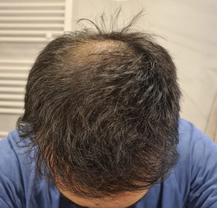 15. 7 months top 1.jpg