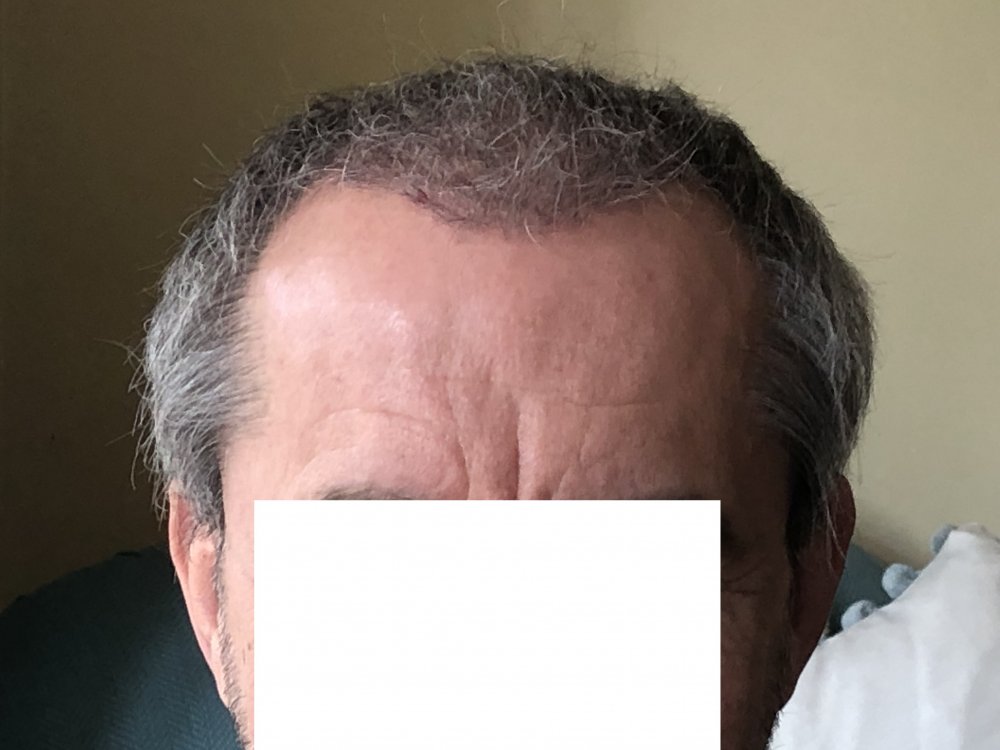 15 weeks post 2983.JPG