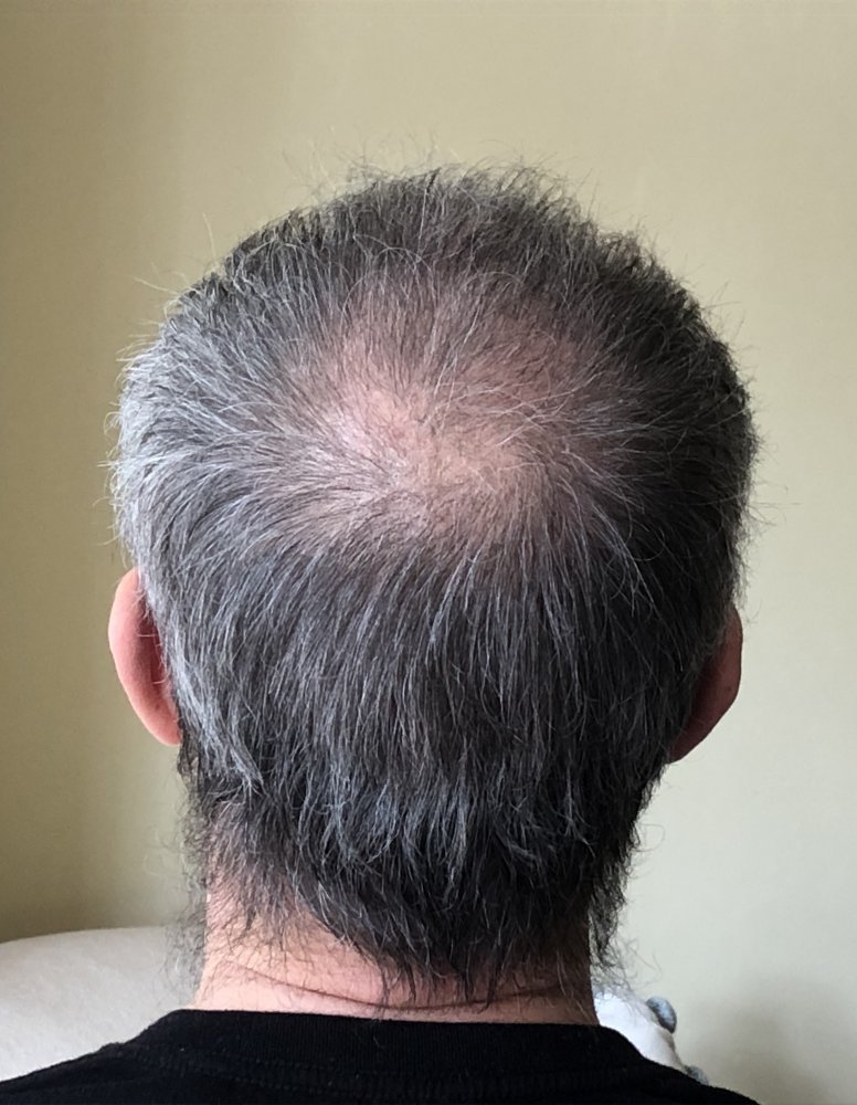 15 weeks post 2990.JPG