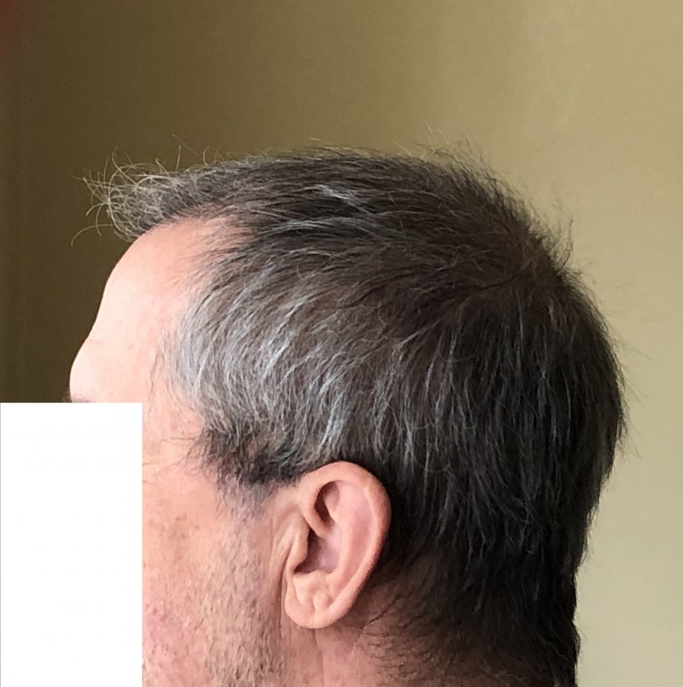 15 weeks post 2994.JPG