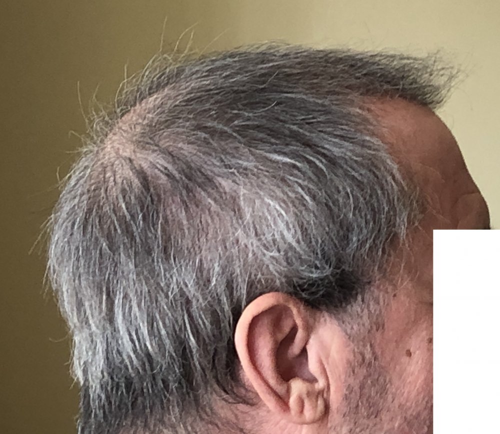 15 weeks post 2997.JPG