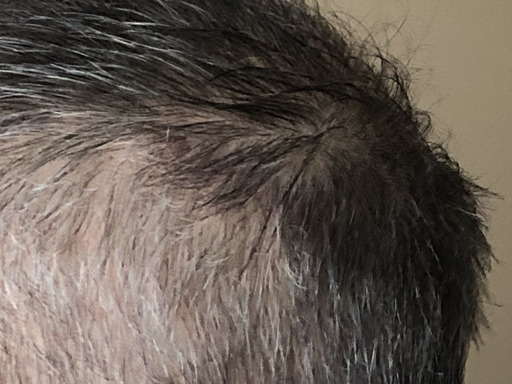 16 weeks, after 1st haircut Close Up Left Side.JPG