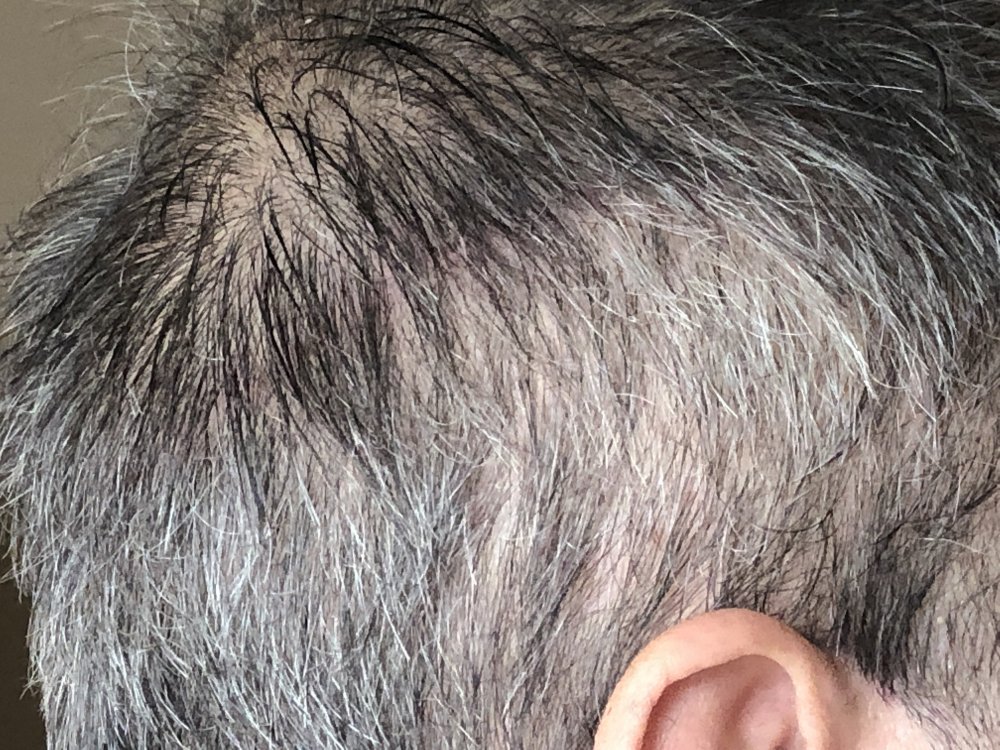 16 weeks, after 1st haircut Close Up Right Side.JPG