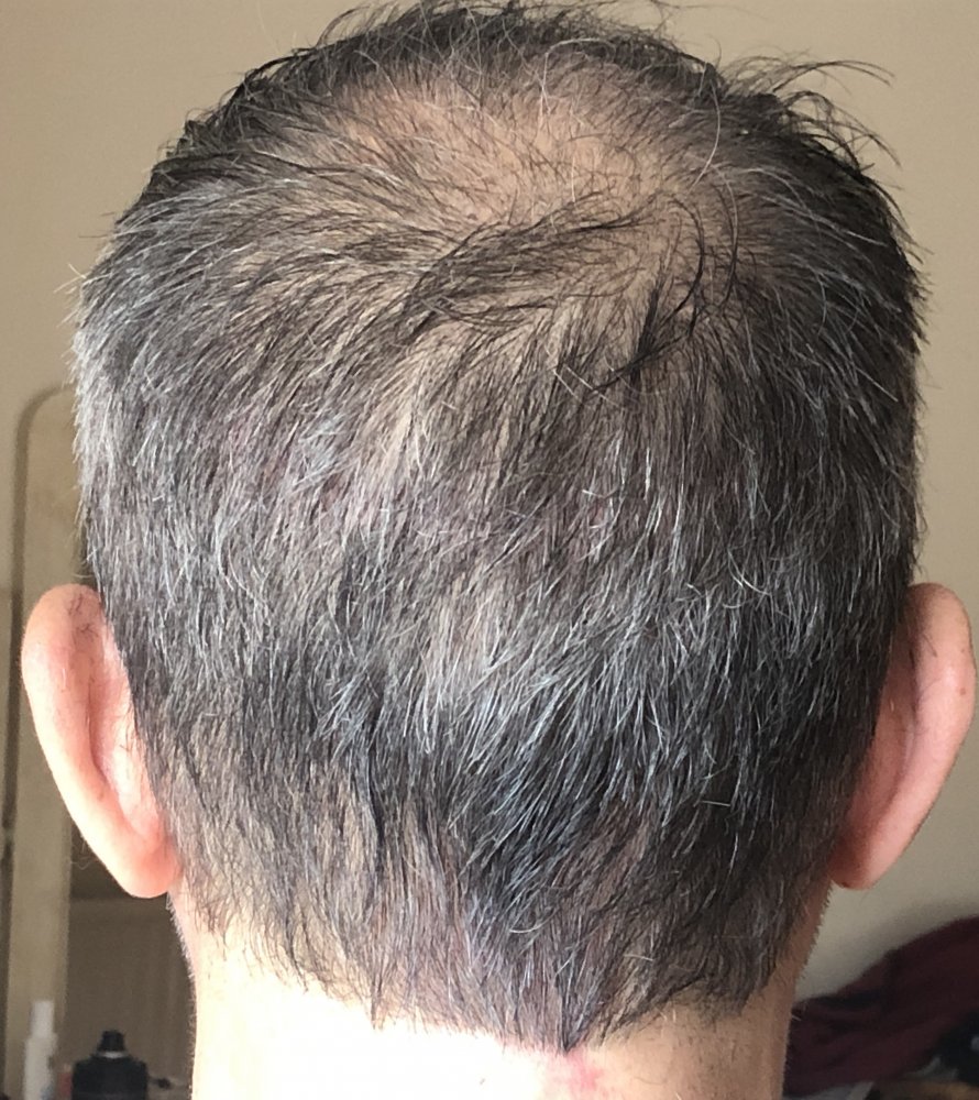 16 weeks, after 1st haircut Rear & Crown.JPG