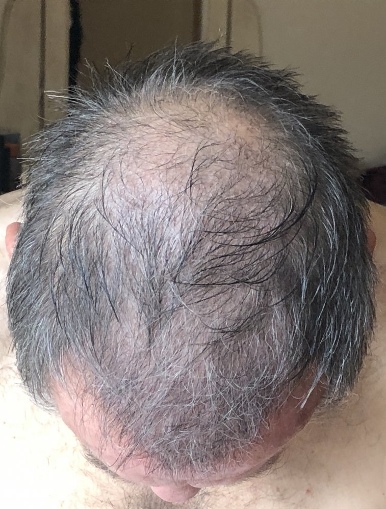16 weeks, after 1st haircut Top.JPG