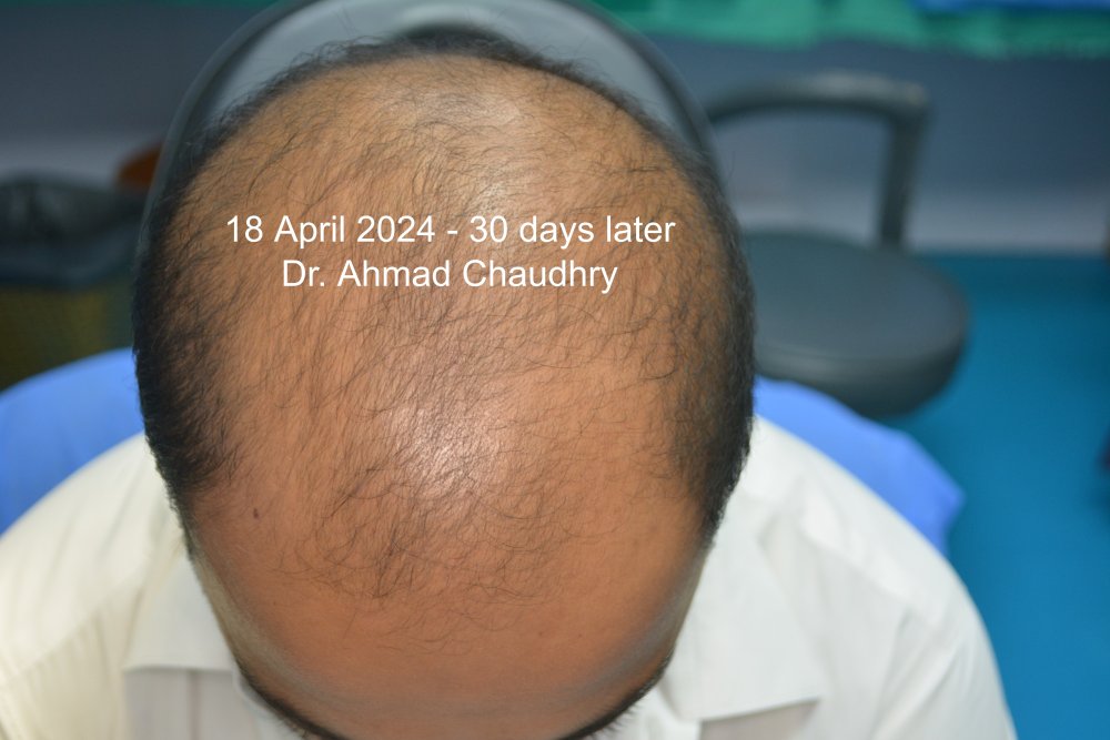 18 April 2024 30 days later.jpg