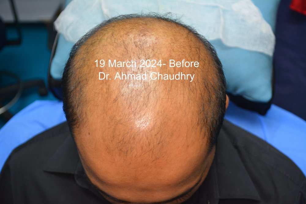 19 March 2024 Before First treatment.jpg