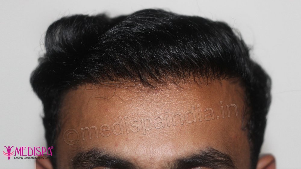 19_front-zoom.jpg